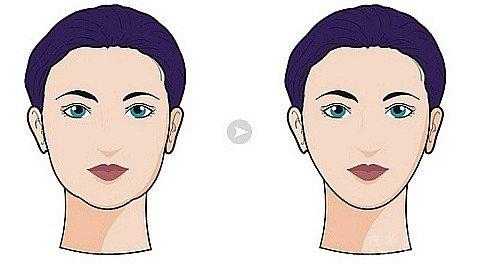 2023哈爾濱哪家E光激光祛痘醫(yī)院口碑好且性價比高？讓我們來看看！