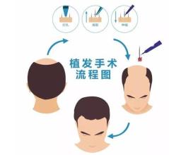 臺(tái)州哪里可以去除下眼皮皺紋？2023臺(tái)州排名前十的美容醫(yī)院推薦