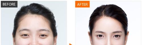 2023淮安酒渣鼻治療排名前10的專(zhuān)業(yè)醫(yī)院匯總