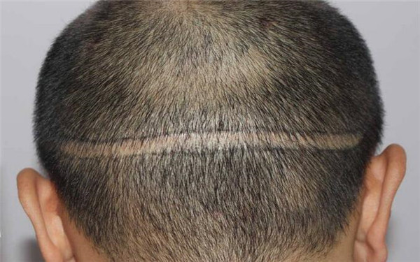 2023昆明眼部除皺手術—揭曉昆明眼部整形醫(yī)院排行榜！