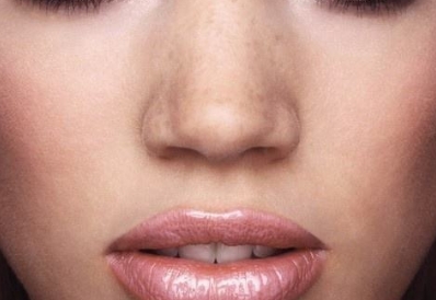 探尋西安擅長激光祛咖啡斑口碑佳的整形醫(yī)院，2023年十強(qiáng)激光祛咖啡斑醫(yī)院揭曉！