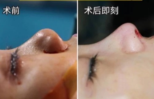 南京最熱門的環(huán)形精雕吸脂醫(yī)療美容醫(yī)院綜合推薦！2023年排行前十名大揭曉！