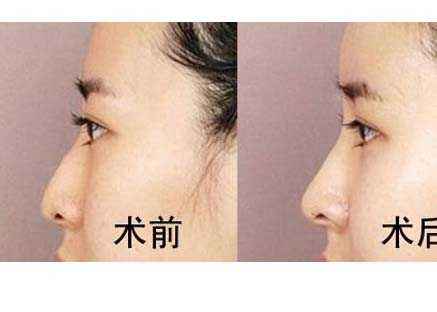 六安市受歡迎的雙眼皮整形美容醫(yī)院排行榜出爐！2023最值得信賴(lài)的明眸翹睫醫(yī)療機(jī)構(gòu)盤(pán)點(diǎn)！