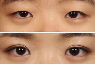 北京射頻瘦腰醫(yī)生