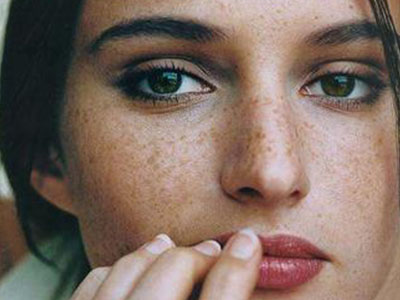 樂清m22非剝脫點(diǎn)陣激光醫(yī)生