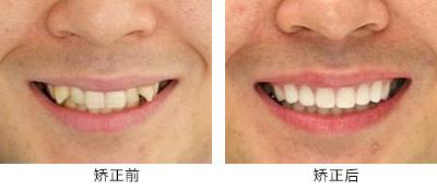 高性?xún)r(jià)比的滁州曼托水滴型假體隆胸整形醫(yī)院推薦！2023年滁州曼托水滴型假體隆胸醫(yī)院TOP10口碑排行，實(shí)力醫(yī)