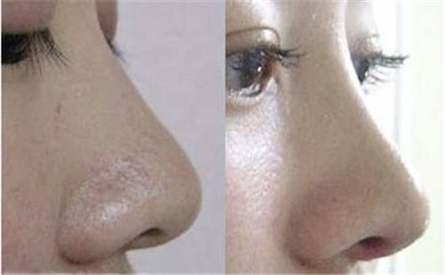 2023年北京填充川字紋凹陷醫(yī)療美容院排名前10的優(yōu)秀口碑醫(yī)院推薦，快速記錄！