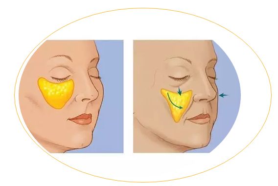 滄州哪家醫(yī)院治痘痘靠譜？推薦2023年口碑前十的權(quán)威整形美容醫(yī)院！