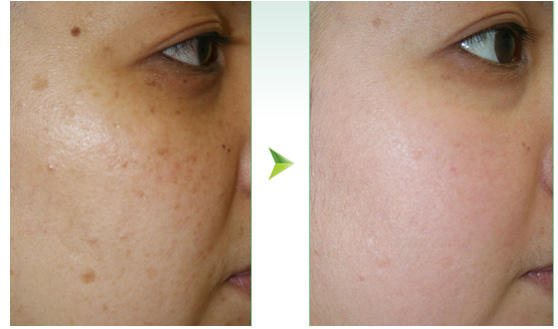 上海無針去淚溝整形醫(yī)院排行榜2023：口碑爆棚的十大醫(yī)院揭秘！