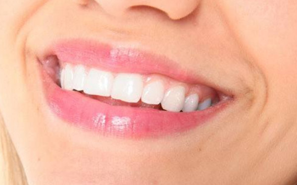 深圳醫(yī)院排行榜！2023年最值得信賴的外切法祛眼袋醫(yī)療美容名單揭曉！