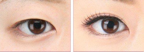 重慶有哪些口碑好的射頻點陣激光祛除疤痕醫(yī)療美容醫(yī)院？2023年排名前十的醫(yī)院哪家服務(wù)較佳？