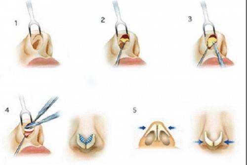 2023常德哪里可以做到去額頭紋的皮秒整形美容醫(yī)院排行榜前10強(qiáng)露面！
