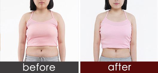 昆明切開法重瞼術醫(yī)生