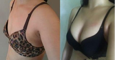 2023年武漢微雕點陣去疤痕十大口碑權(quán)威整形醫(yī)院揭秘！