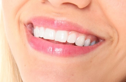 2023年，石家莊非常受歡迎的動態(tài)細紋醫(yī)院排行榜前十震撼發(fā)布！