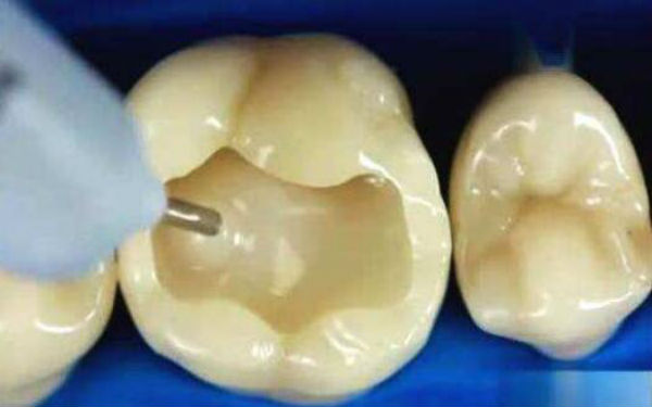 廣州哪家醫(yī)院針雕祛除眉間紋效果比較好？2023年排名前十名單揭曉！