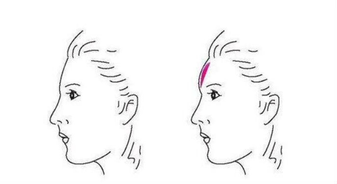 2023年安康市排名前10的專業(yè)整容醫(yī)院，注射自體脂肪顆粒豐顳術(shù)技術(shù)好！