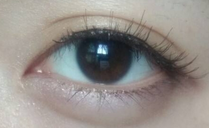 2023年強(qiáng)勢(shì)來(lái)襲！德州整形醫(yī)院推出全臉去痣首選，前十強(qiáng)榮耀問(wèn)世！