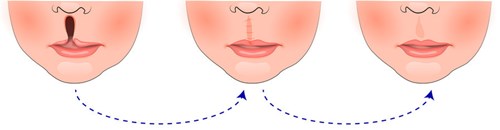 青島哪家醫(yī)院的微雕去眉間紋效果好？2023年排名前十實(shí)力醫(yī)院推薦！