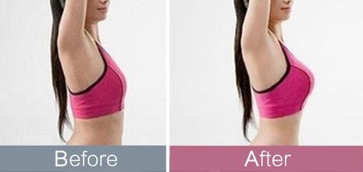 揭秘2023深圳治療抬頭紋熱門醫(yī)院排行榜top10！這些明星醫(yī)院廣受推崇，種草不斷！