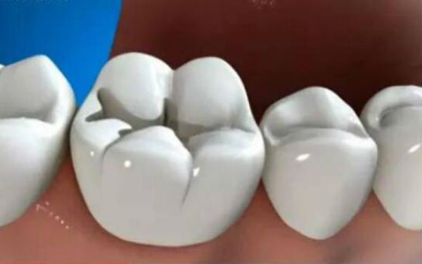 2023三亞微晶祛痘坑整形醫(yī)院排名前十，哪家性價比高？