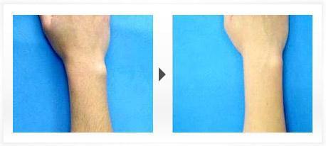 長(zhǎng)沙微創(chuàng)印第安紋整形醫(yī)院2023年評(píng)價(jià)TOP10強(qiáng)名單發(fā)布