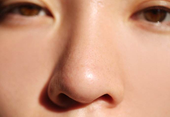 襄陽(yáng)切除眼睛細(xì)紋醫(yī)生