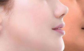 昆山玻尿酸豐上唇珠醫(yī)生