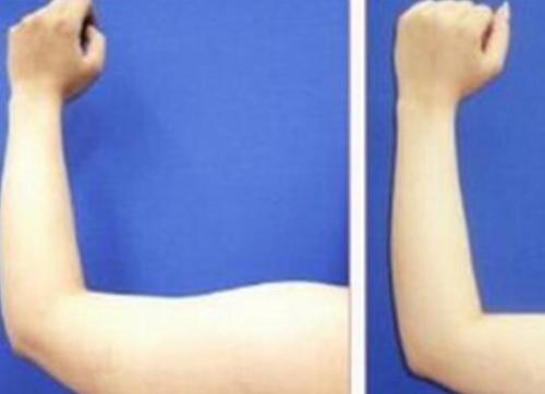 綿陽鼻背寬整形醫(yī)院推薦！2023綿陽鼻背寬美容醫(yī)院排行榜出爐，網(wǎng)友大贊這些！