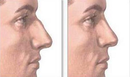 2023年合肥治療筒狀乳房畸形首選的專業(yè)整形醫(yī)院排行榜TOP10強推薦！