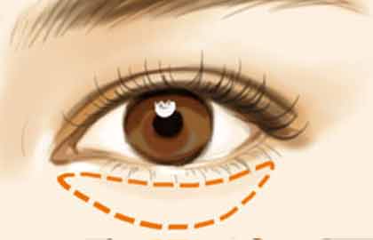 2023沈陽重瞼整形美容醫(yī)院哪家好？推薦10家技術過硬的醫(yī)療整形機構！