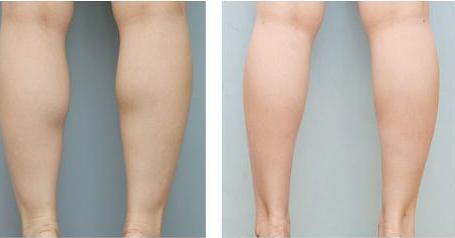 重慶馥蘭朵雙眼皮整形醫(yī)院排行榜2023年前十名單公布，專業(yè)技術(shù)與優(yōu)勢(shì)盡現(xiàn)！