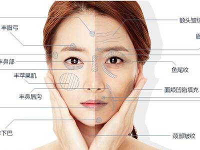 廣州臉部打溶脂針排名前10的美容醫(yī)院口碑大揭秘！2023年很受好評的整形醫(yī)院技術盤點！