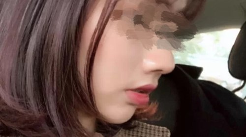 貴陽有哪些專業(yè)的磨皮去痘印醫(yī)院？2023年TOP10推薦實力醫(yī)院揭曉