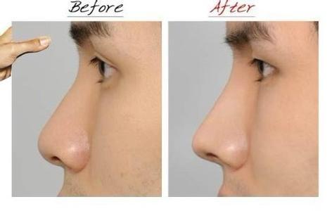 2023深圳E光腿部脫毛整形美容醫(yī)院推薦榜單前十強(qiáng)揭曉！這些醫(yī)院名氣大、口碑好，一定要了解！