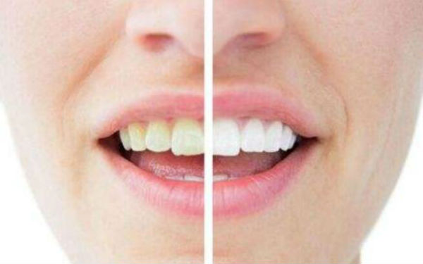 深圳豐太陽(yáng)穴整形醫(yī)院口碑非好好！2023年十佳面部注射豐太陽(yáng)穴醫(yī)院排名出爐