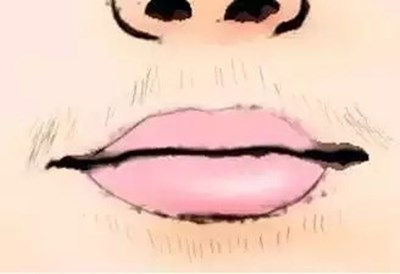 泰州鼻唇溝醫(yī)療美容醫(yī)院口碑好的推薦！2023泰州肉毒素打鼻唇溝top10強(qiáng)勢醫(yī)院震撼登場！