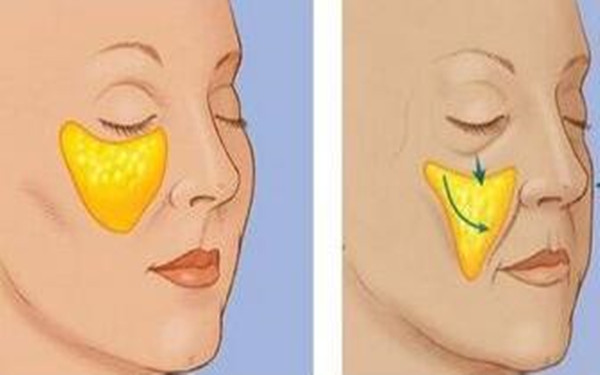 2023安徽更受矚目的臉部大拉皮整形醫(yī)院排行榜發(fā)布！十大備受好評的安徽臉部大拉皮手術(shù)醫(yī)院匯總！
