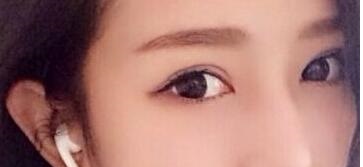 2023年山東哪些醫(yī)療美容醫(yī)院推薦度高，專業(yè)祛除眼周紋的前十家？