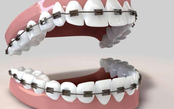 杭州冰點(diǎn)脫毛醫(yī)院排名前10，揭秘2023年的榜單！