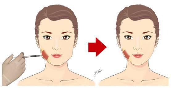 成都隆鼻整形醫(yī)院TOP10名單公布，2023年最受贊譽的美容醫(yī)院詳細概況！