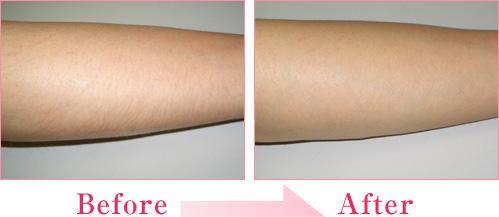 2023年佛山乳房切除醫(yī)院十佳口碑排行榜出爐，權(quán)威醫(yī)院值得信賴！