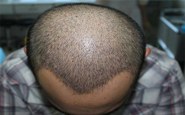 2023年上海非常受歡迎的治療青春痘醫(yī)院排行榜：專業(yè)解決青春痘的十家醫(yī)療美容機(jī)構(gòu)揭曉！