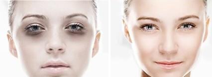 北京哪些醫(yī)院的激光去黑頭效果好？2023年排名前10的強整形醫(yī)院推薦！