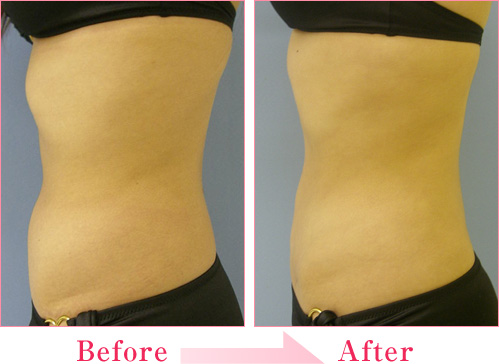 2023年，桂林哪家醫(yī)療整形醫(yī)院排名前十的專業(yè)眼紋去除法整形醫(yī)院