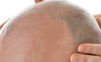 寧波市有哪些口碑比較好的整形美容醫(yī)院？2023年推薦的綜合鼻整形前十名！