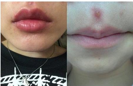 2023青島哪些醫(yī)院口碑好，提供專業(yè)的提拉魚尾紋醫(yī)療美容服務(wù)？青島魚尾紋醫(yī)院TOP10強(qiáng)機(jī)構(gòu)推薦