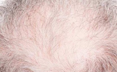 2023成都領(lǐng)先的隱私光電抗衰整容醫(yī)院排名前10公布！