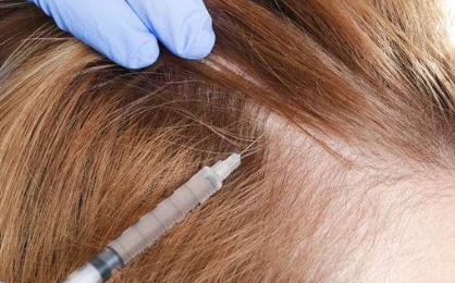 2023年舟山哪家整形醫(yī)院的玻尿酸墊鼻效果？整形醫(yī)院推出了前10名的紅榜！