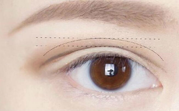 2023西安黃褐斑祛除醫(yī)院排行榜出爐！這十所醫(yī)療整形醫(yī)院備受好評！